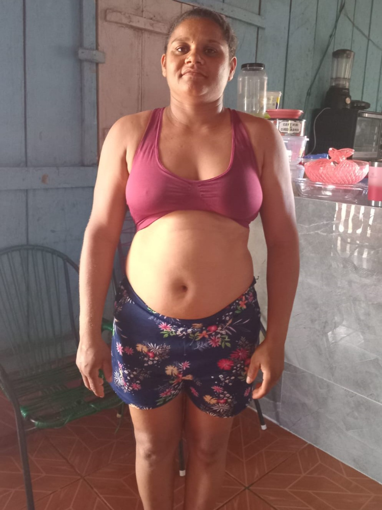 Aluna 1 antes